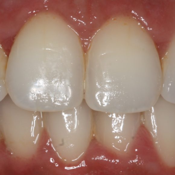 Orthodontie