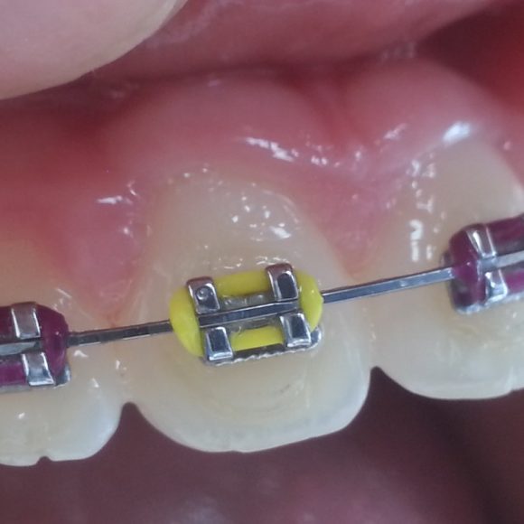 Orthodontie